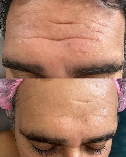 Image de KOBA - Lifting sans aiguille (à domicile)